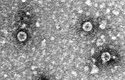 Mit diesen MS2-Phagen beladen die Hohenstein Institute ihre Bioindikatoren zur...