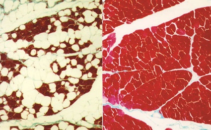 Deutlicher Unterschied: „überstimulierter (links) und gut erhaltener...