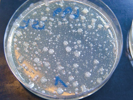 Keime bilden Kolonien, die sich zu einem schleimartigen Biofilm verbinden...