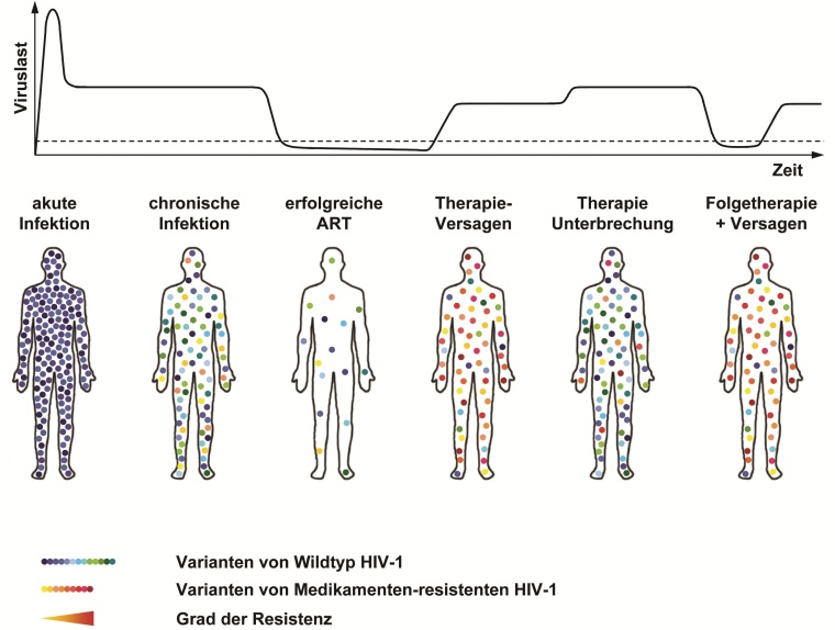 Modell der Verteilung viraler Populationen von HIV-1 im Zeitalter der ART.