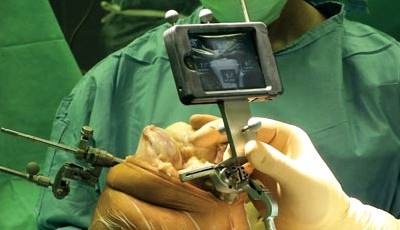 Klein und handlich ist der neue Assistent, der Chirurgen bei Operationen an...