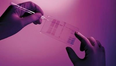 Die personalisierte Medizin benötigt Unterstützung durch...