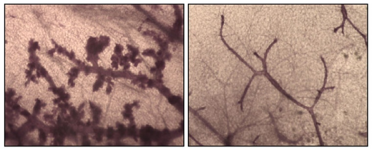 Brustdrüsen von 4 Monate alten Mäusen, die eine Mutation im BRCA1-Gen tragen....