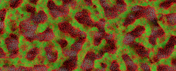 Biofilm eines klinischen Isolates von Pseudomonas aeruginosa in der...