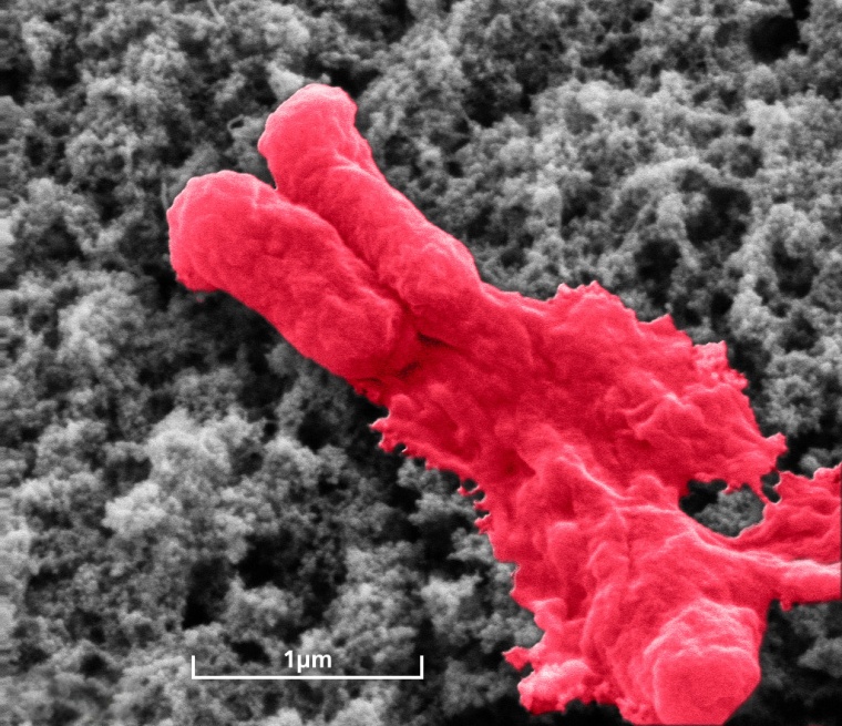 Antibiotikabeschichtung lysiert Bakterium (E.coli) Foto: Fraunhofer IFAM