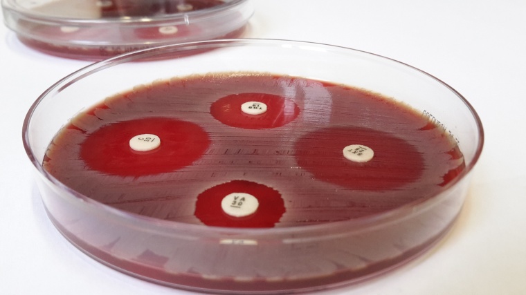 Der Plättchentest macht Antibiotika-Resistenzen sichtbar. Foto: Fabian...