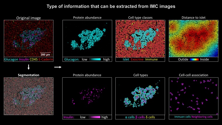 Die bildgebende Massenzytometrie leistet einen wertvollen Beitrag dazu , den...