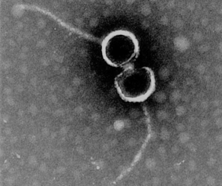 Elektronenmikroskopische Aufnahme von Bakteriophagen, Foto: Dinhopl