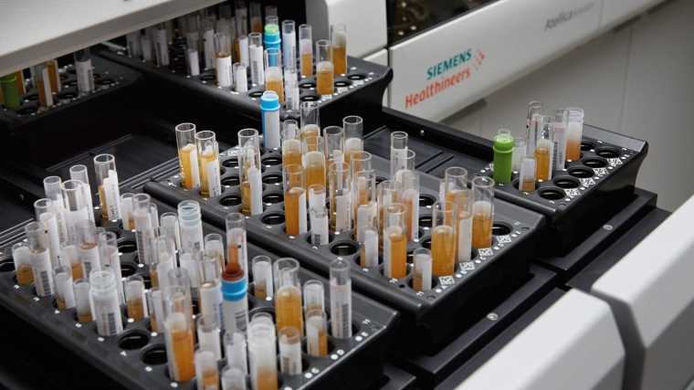 Labordiagnostiksystem Atellica Solution von Siemens Healthineers