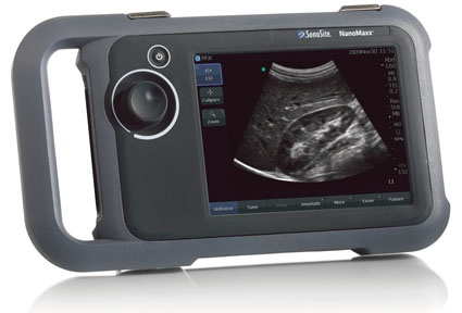 Das NanoMaxx Ultraschallsystem von SonoSite