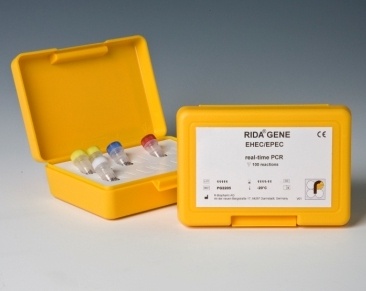 Escherichia coli – ein Keim mit vielen Gesichtern