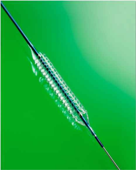 Das neue bioresorbierbare Gefäßgerüst aufdem Ballonkatheter (Foto: Abbott...