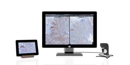Das Digitale Cockpit ermöglicht die Beurteilung von Gewebeschnitten zu jeder...