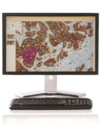 Automatische Bildanalyse mit Ventana Virtuoso (Foto: Roche).