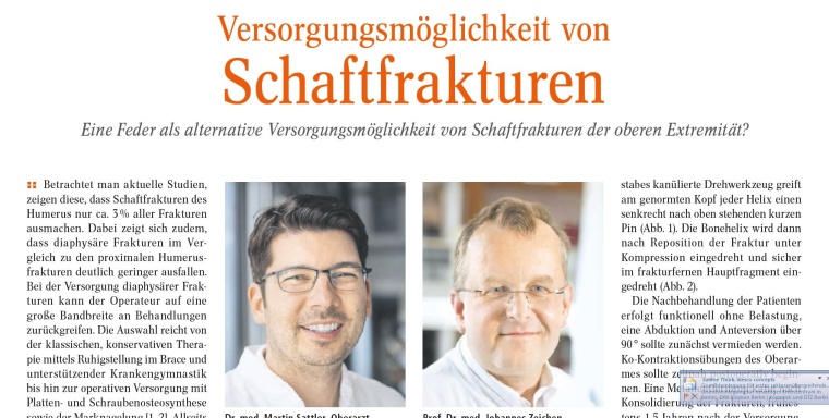 Versorgungsmöglichkeit von Schaftfrakturen - Eine Feder als alternative...