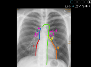 Einblick in einen CoRad-19-Kurs zum Thema „Thorax-Radiologie für Studierende...