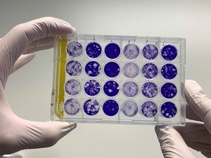 Plaque-Reduktionstest zur Bestimmung neutralisierender Antikörper. Foto:...