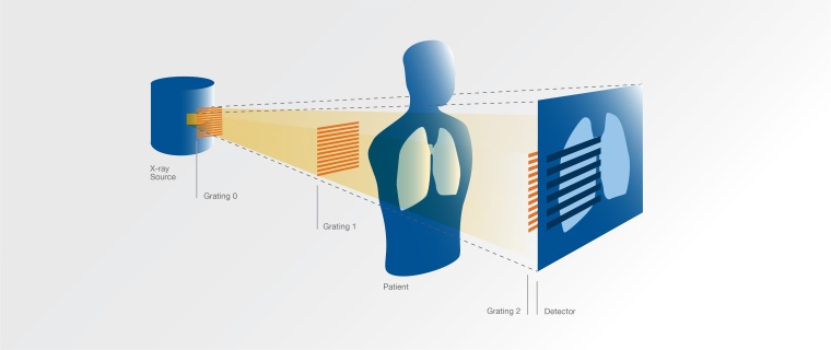 Schema eines Geräts für die Dunkelfeld-Bildgebung mit Röntgenlicht. Foto:...