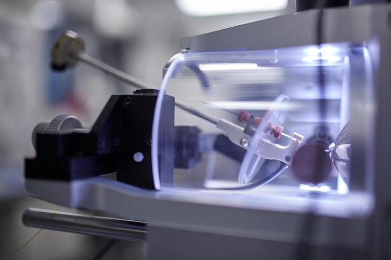 Mithilfe von Massenspektrometrie haben Forschende Biomarker-Profile...