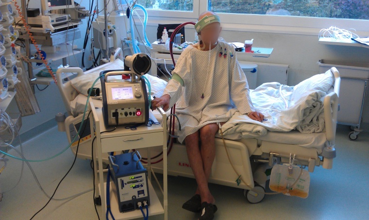 Patient mit extrakorporaler Lungenunterstützung (ECMO) vor der täglichen...