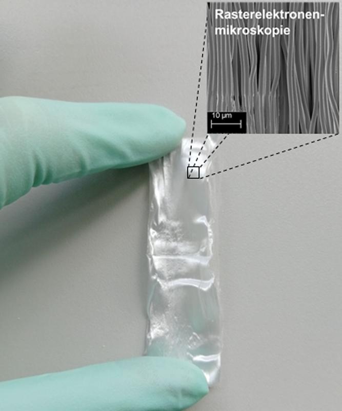 Elektrogesponnenes Vlies mit gerichteten Polymerfasern. Foto: Innovent