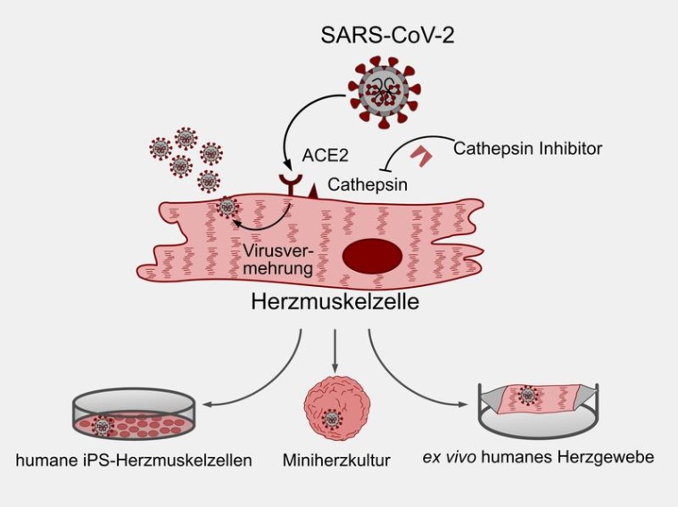 DZHK-Forscher konnten in Labormodellen zeigen, dass SARS-CoV-2 Herzmuskelzellen...
