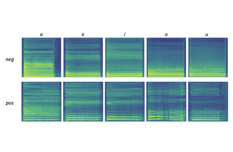 Bildausschnitt aus einer Auswertung der SpracherkennungsApp Fotos: Universität...