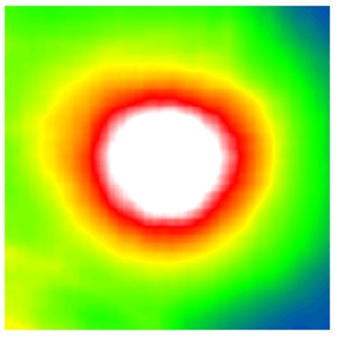 Vorhergesagte Netzhautdicke auf Basis von Fundus-Bildern. Foto Helmholtz...