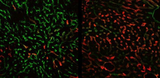 Die Immunfluoreszenzfärbung für Endomucin (in grün) und LYVE-1 (in rot)...