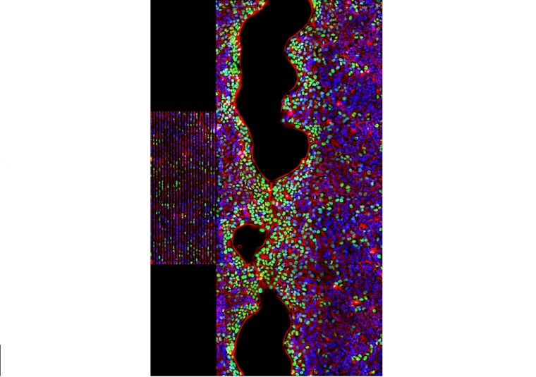 Dreifarbenaufnahme stimulierter Zellen auf einem SAW-Chip. Rot:...