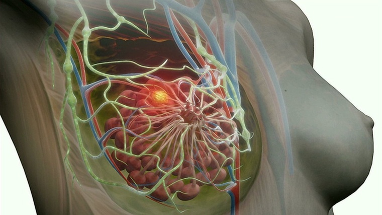 Wiley: Brustgesundheit, Gettyimages