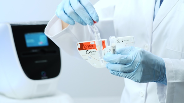 Direkte Eingabe des Abstrichtupfers, einfach und sicher. Foto: Christian...