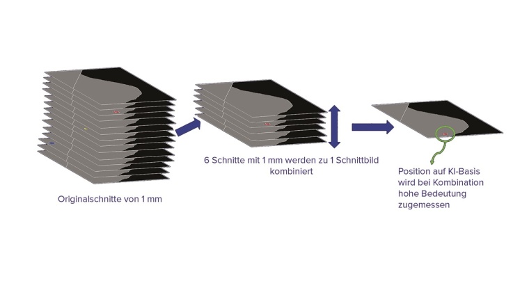 Bild: Hologic Medicor