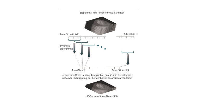 Bild: Hologic Medicor