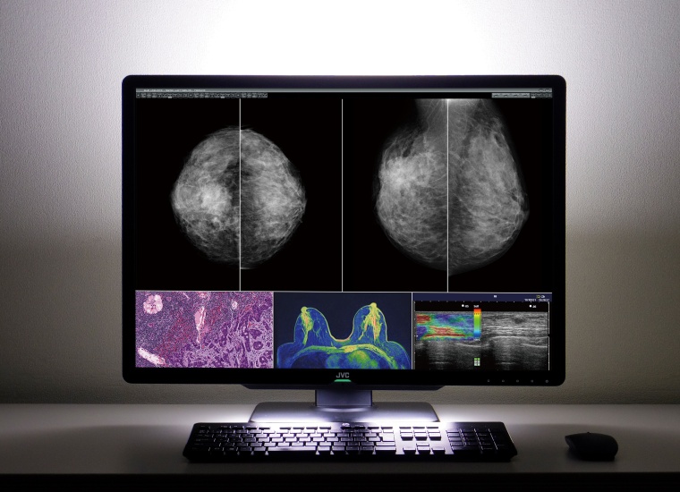 30,9-Zoll-Farbmonitor CL-S1200 Foto: JVC