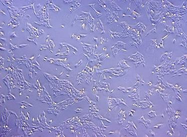 FOXR2 produzierende Neuroblastom-Zellen einer Zelllinie. Foto: DKFZ