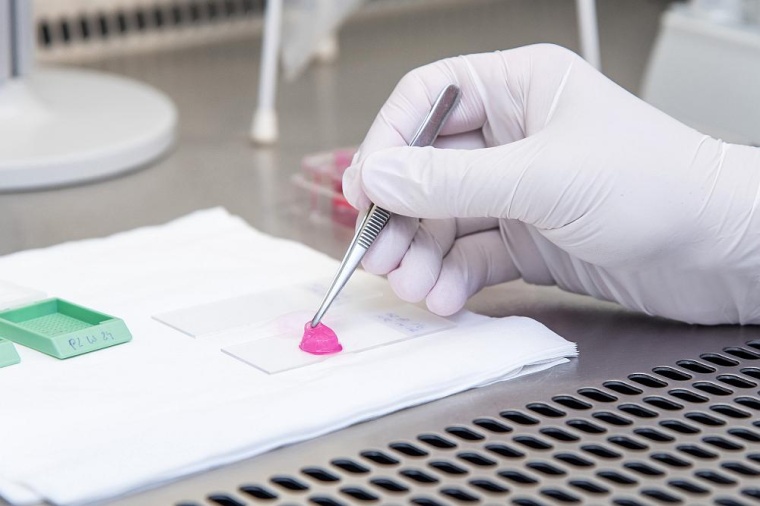 Als Alternative zu Tierversuchen entwickelt ein Forschungsteam am Uniklinikum...