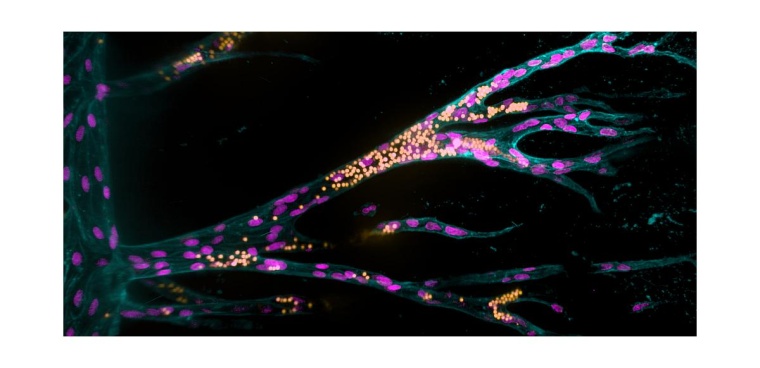 Aus einem Ursprungsblutgefäß (senkrecht links im Bild) bilden Endothelzellen...