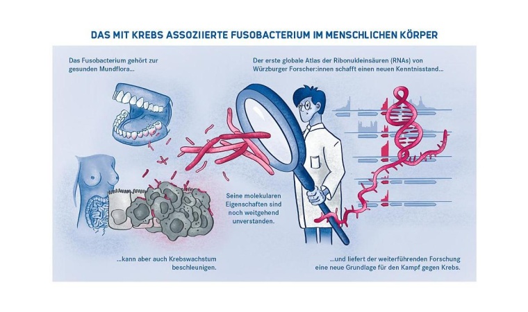 Das mit Krebs assoziierte Fusobacterium im menschlichen Körper. © HIRI/Sandy...