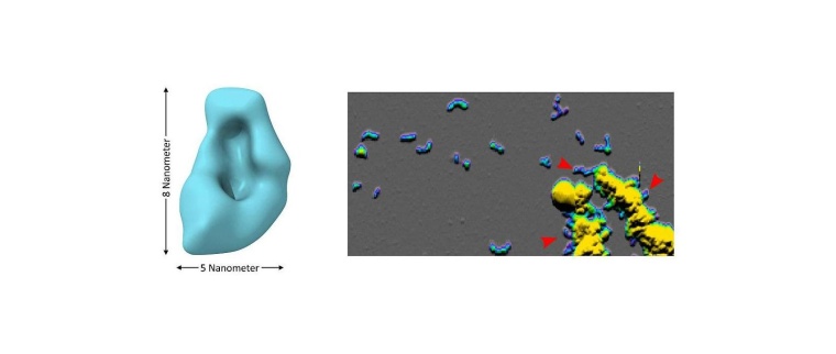 In saurem Milieu bilden sich Aβ-Oligomere (links: Kryo-EM, rechts:...