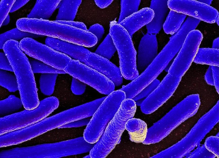 Das stäbchenförmige Escherichia coli-Bakterium kann schwere Infektionen...