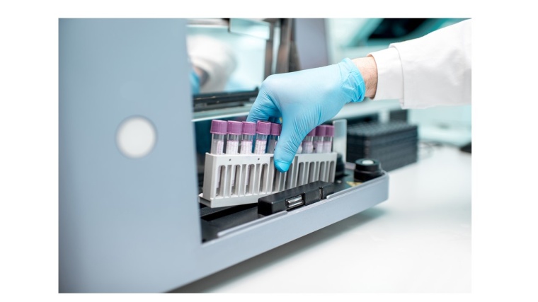 Mit Automatisierungsprozessen Einsparpotenziale nutzen. Foto: CliniSys | MIPS