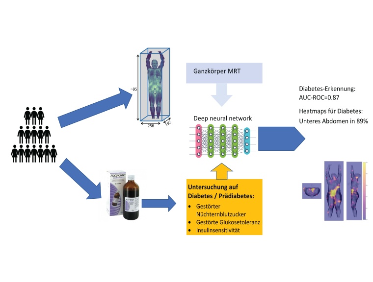 Diabetes-Erkennung aus Ganzkörper-Magnetresonanztomografie mit Deep-Learning....