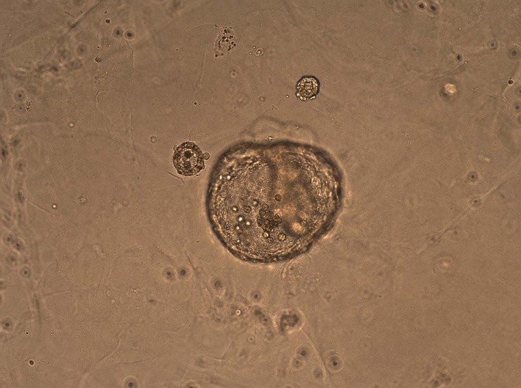 Es dauert im Labor etwa drei Wochen, bis das blasenartige Modell der unreifen...