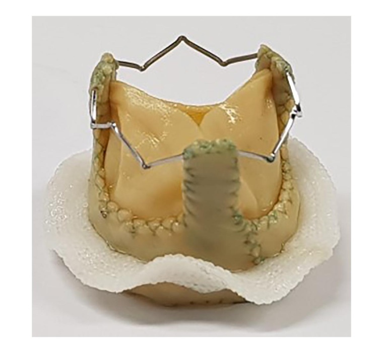 Biologische Herzklappe mit Metallgerüst. © Fraunhofer IKTS