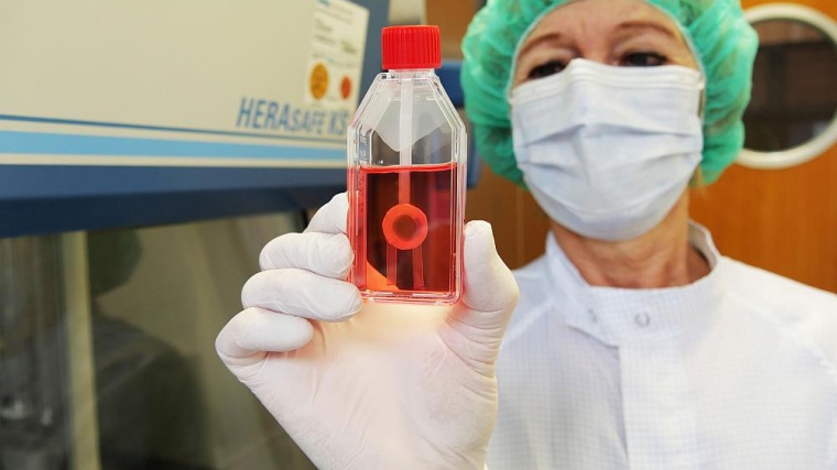 Ein Großteil der am Uniklinikum Würzburg gespendeten Gewebe sind...