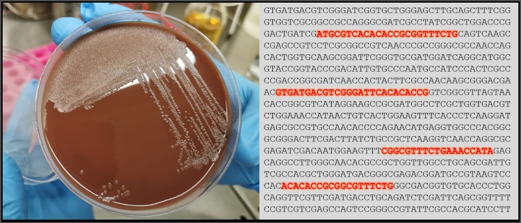 Klassische Haemophilus influenzae Kultur (l.) und Ausschnitt aus einer...
