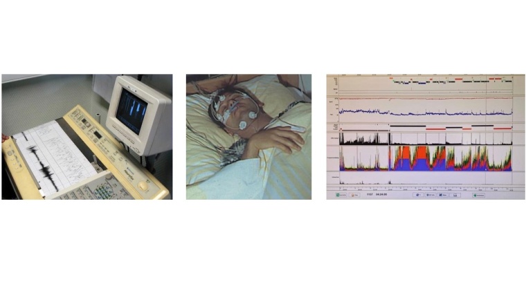 Fortschritt in der Schlafmedizin: im Zentrum steht der Mensch. Links alte...