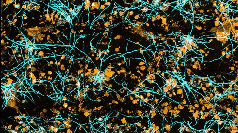 Pilzhyphen durchdringen Lungenepithelzellen. © Zoltán Cseresnyés/Leibniz-HKI