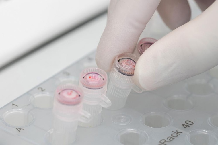 Virenforschung an der Universität Ulm. Foto: Elvira Eberhardt / Uni Ulm